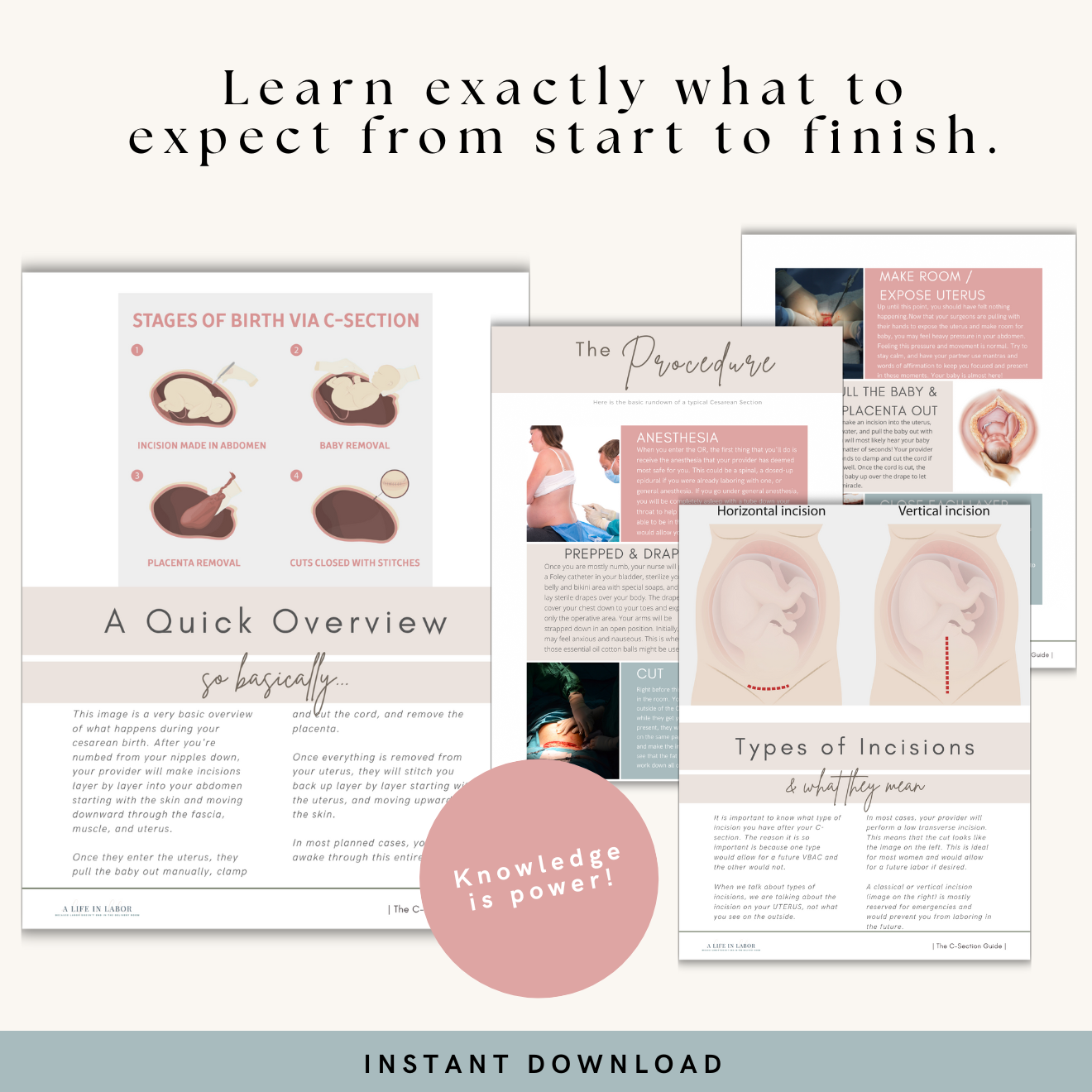 C-Section Guide