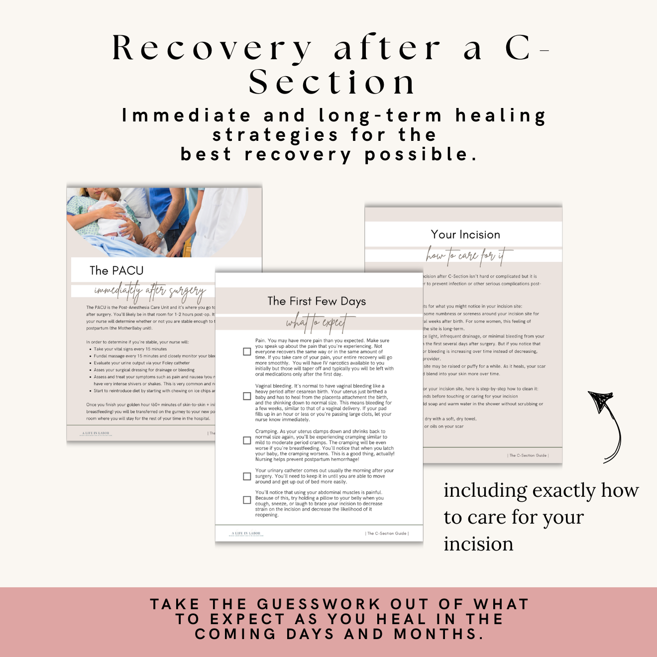 C-Section Guide